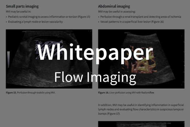 Whitepaper / Flow imaging